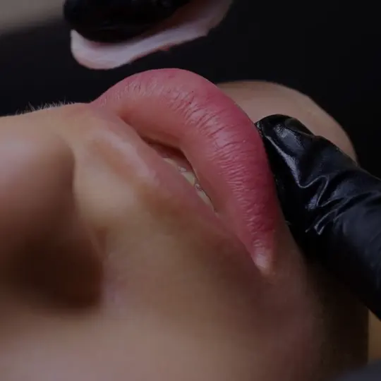 PMU Lippen Entfernung