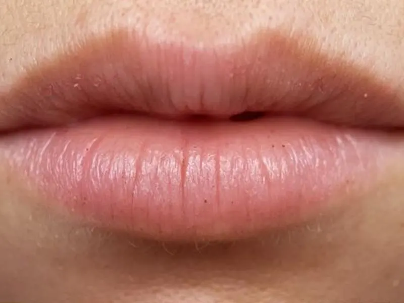 Permanent Make-up Lippen vorher Beispiel 1