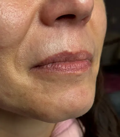 Permanent Make-up Lippen vorher Beispiel 2