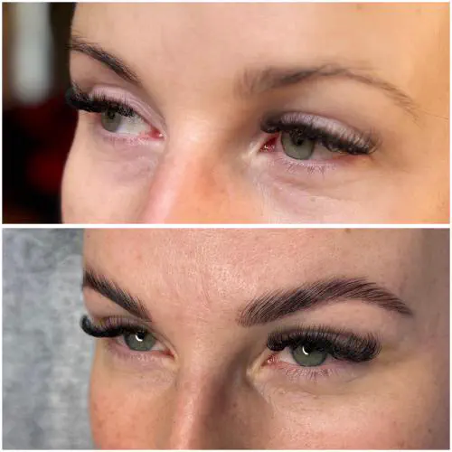 Brow- und Lashlifting