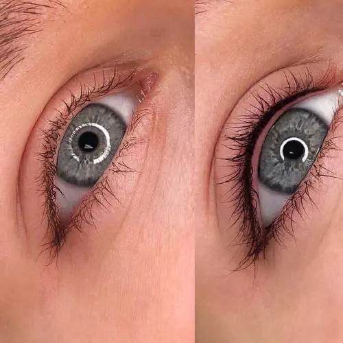 Lidstrich Vorher Nacher