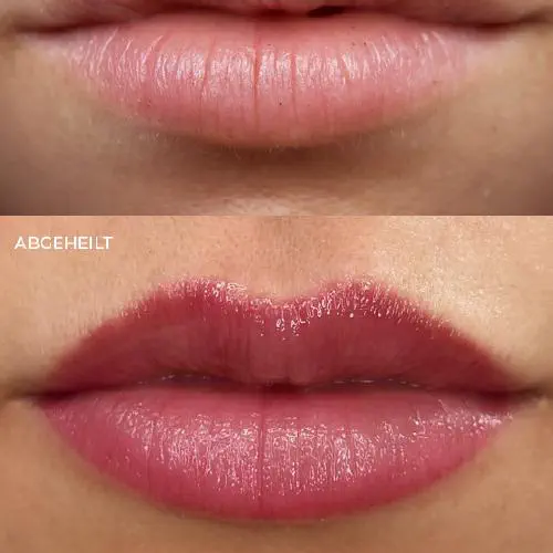 PMU Lippen voher und nacher