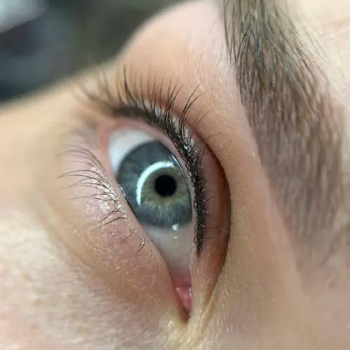 Wimpernkranzverdichtung Coverbild